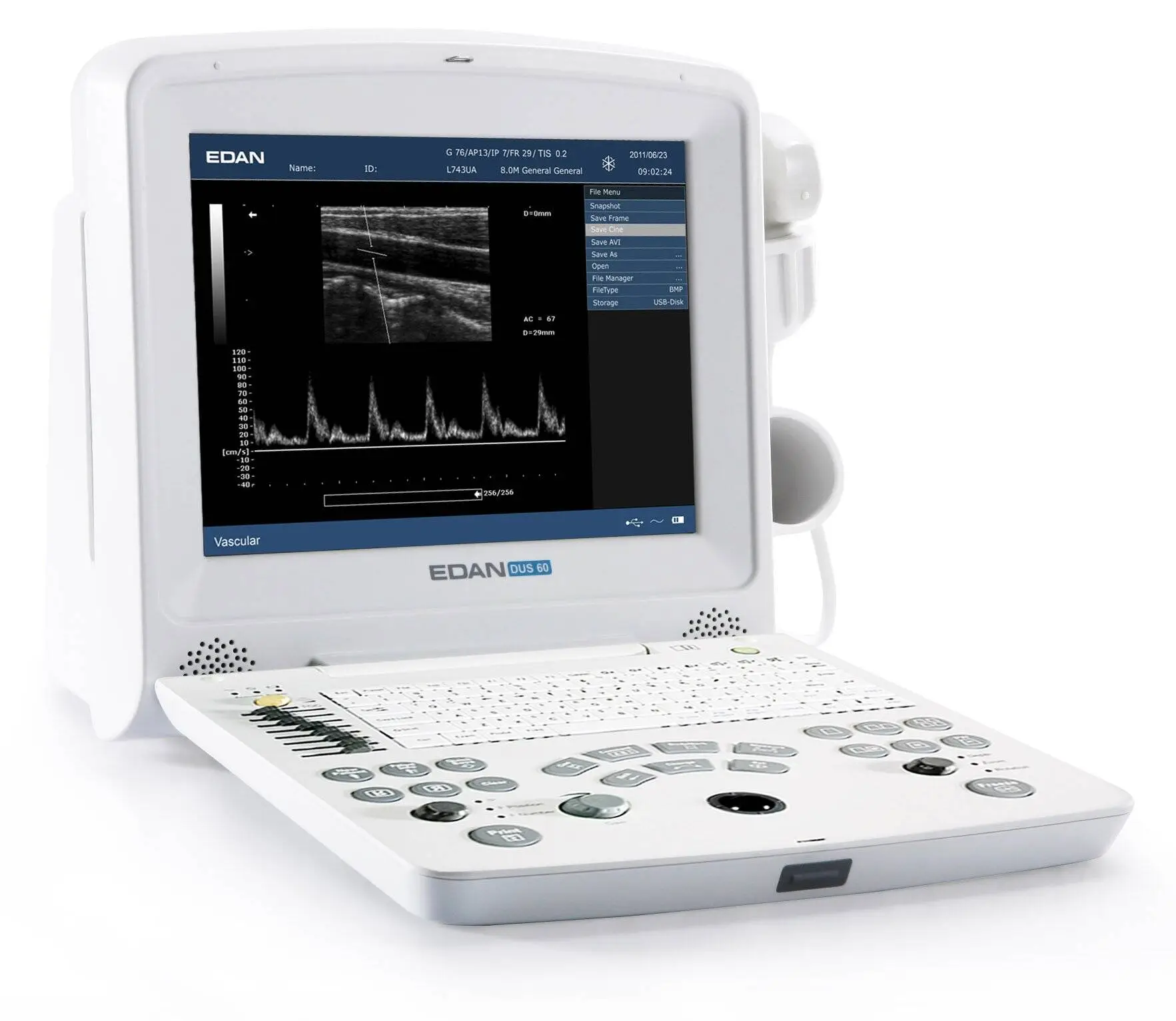 Edan DUS 60 Vet Ultrasound
