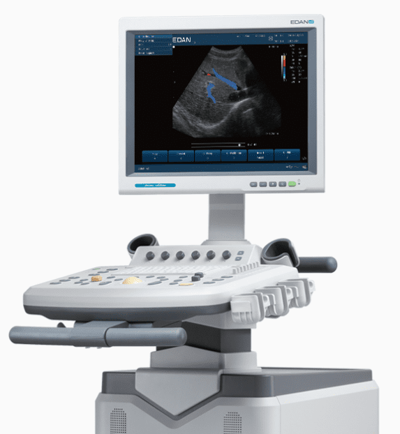 Edan U2 Ultrasound