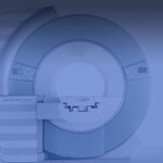 Open Bore MRI Systems