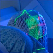 patient positioning lasers