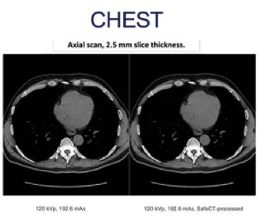 safe ct 2