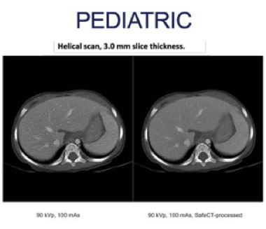 safe ct 4
