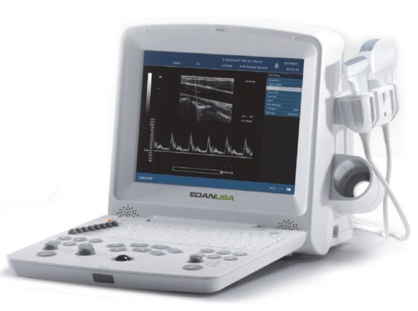 Edan DUS 60 Ultrasound