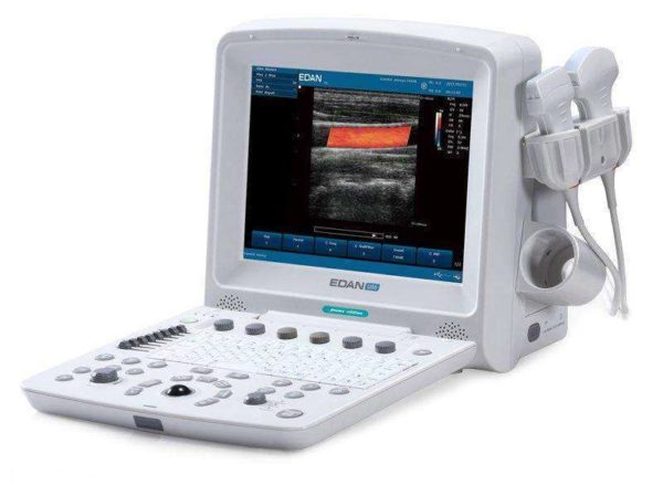 Edan U50 Ultrasound