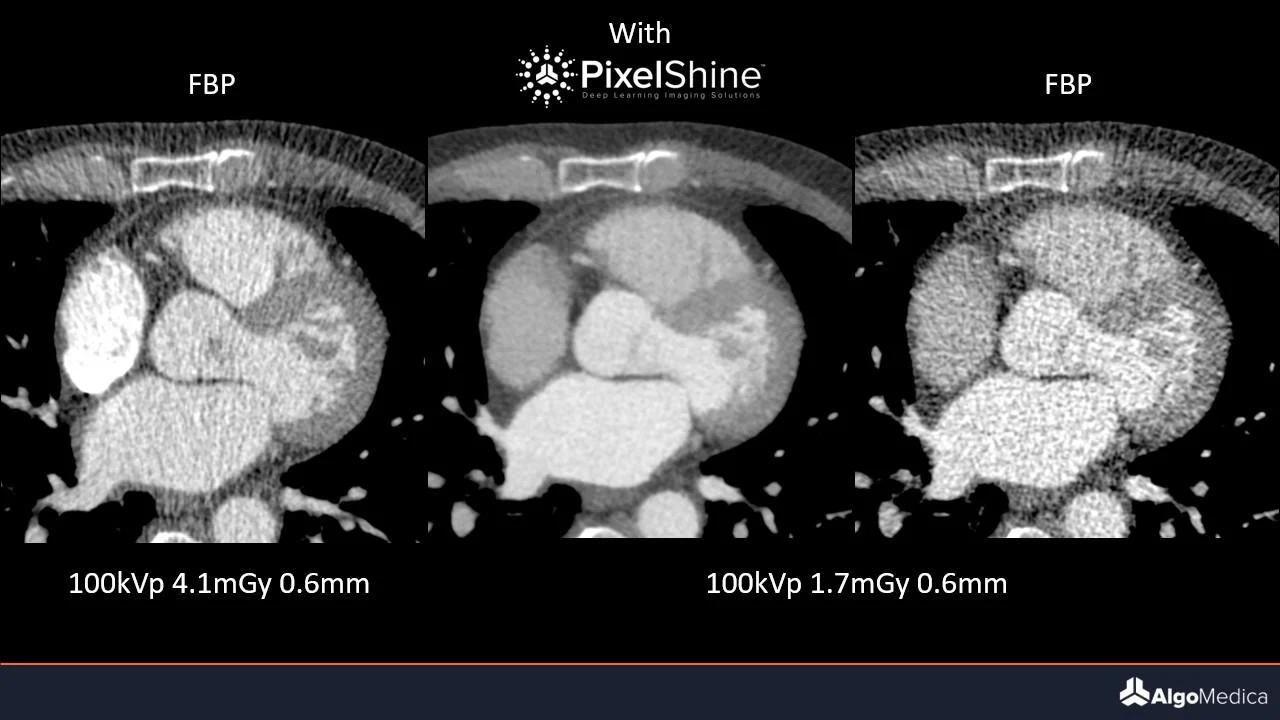 Pixelshine Comparison Algomedica