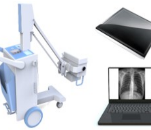 Perlove Mobile digital X Ray Systems
