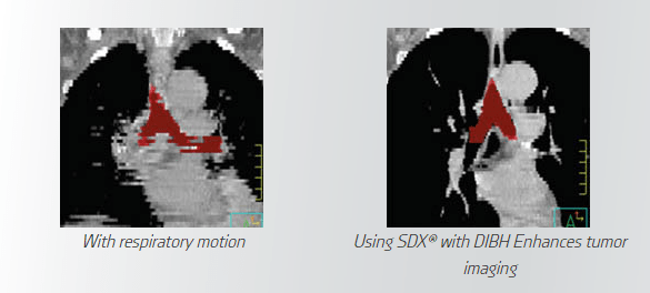 SDX Images